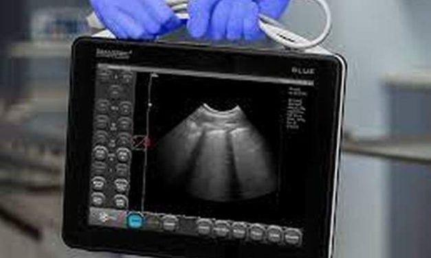 The Bright Side, August 17, 2022